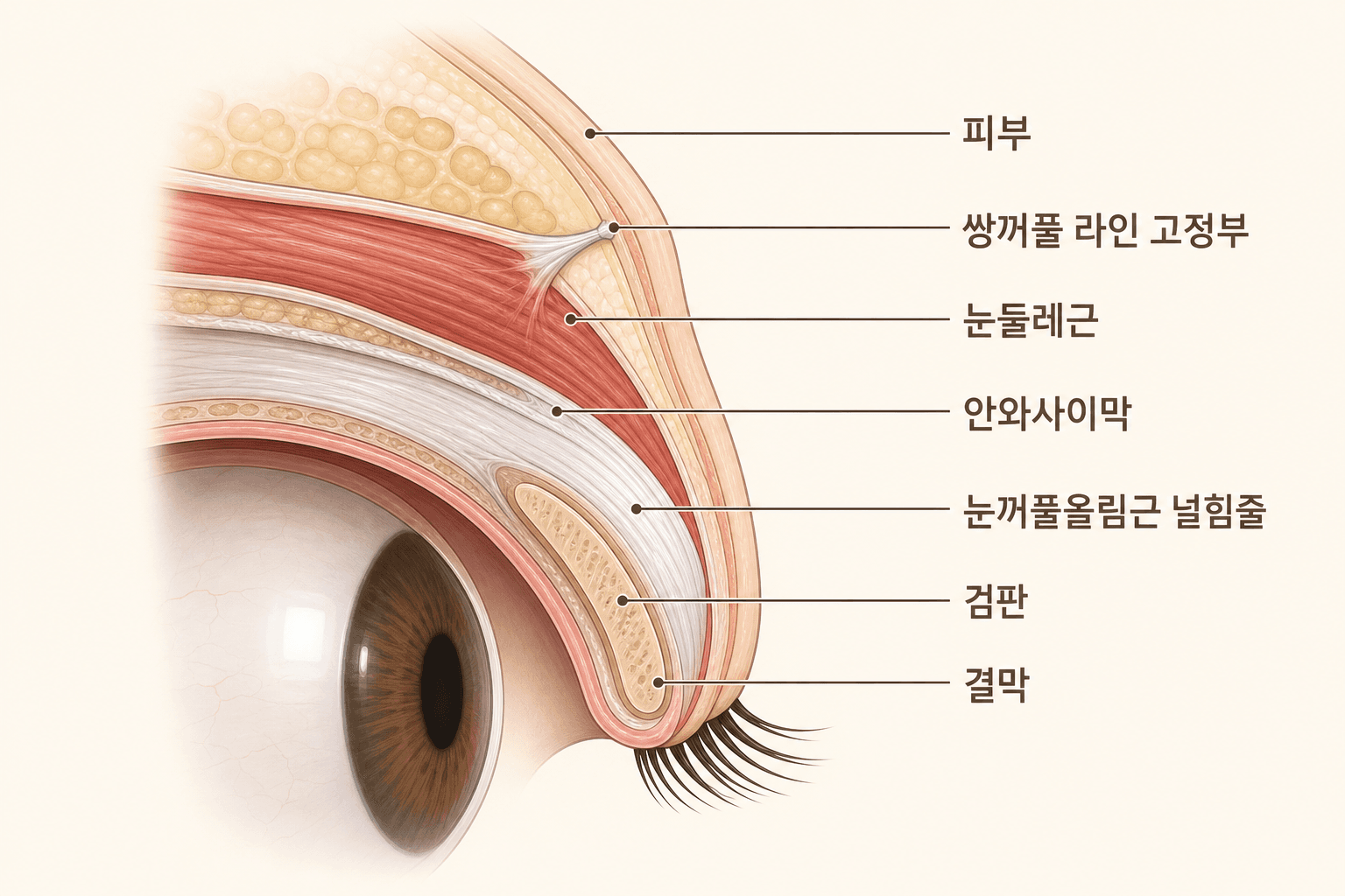 윗눈꺼풀 층 구조 해부 단면도 — 표면부터 피부, 쌍꺼풀 라인 고정부, 눈둘레근, 안와사이막, 눈꺼풀올림근 널힘줄(거근건막), 검판, 결막 순으로 표기. 쌍꺼풀 라인은 거근건막이 피부 쪽으로 연결되는 지점에서 만들어지며, 재수술의 유착·박리는 이 층 사이에서 다뤄진다