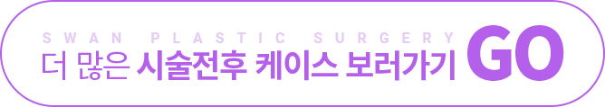 더 많은 시술전후 케이스 보러가기