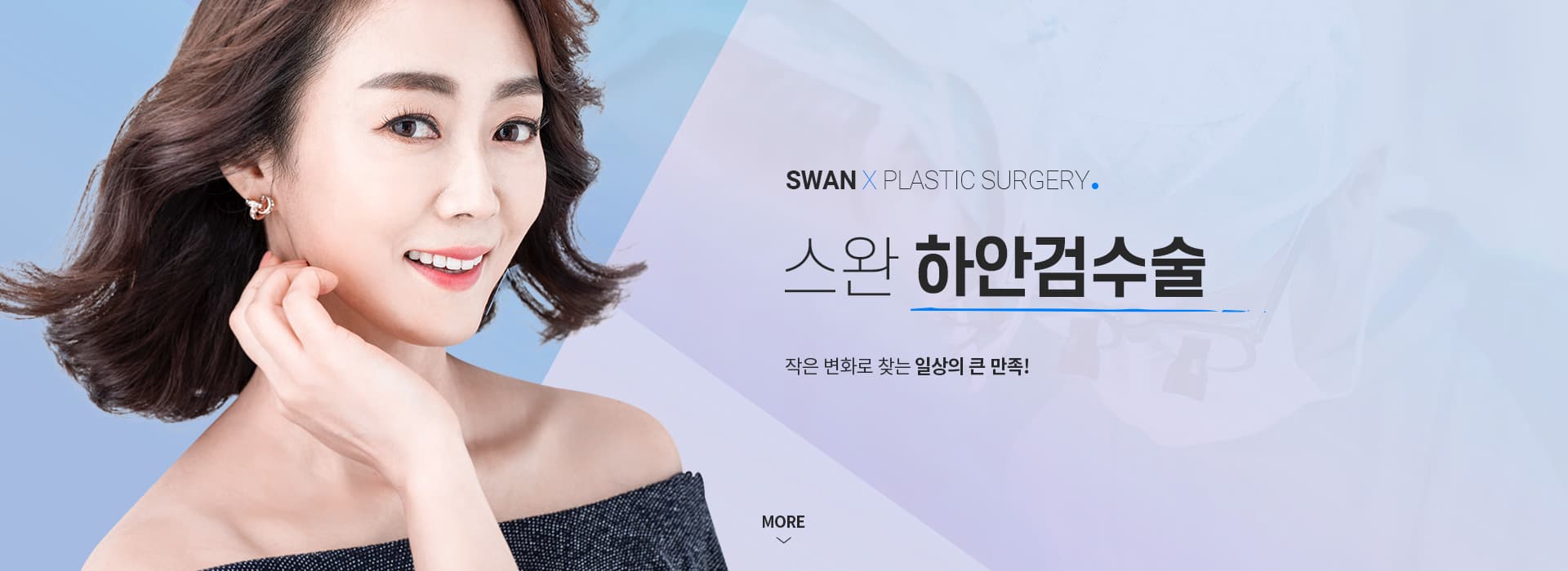 스완 하안검수술 키비주얼