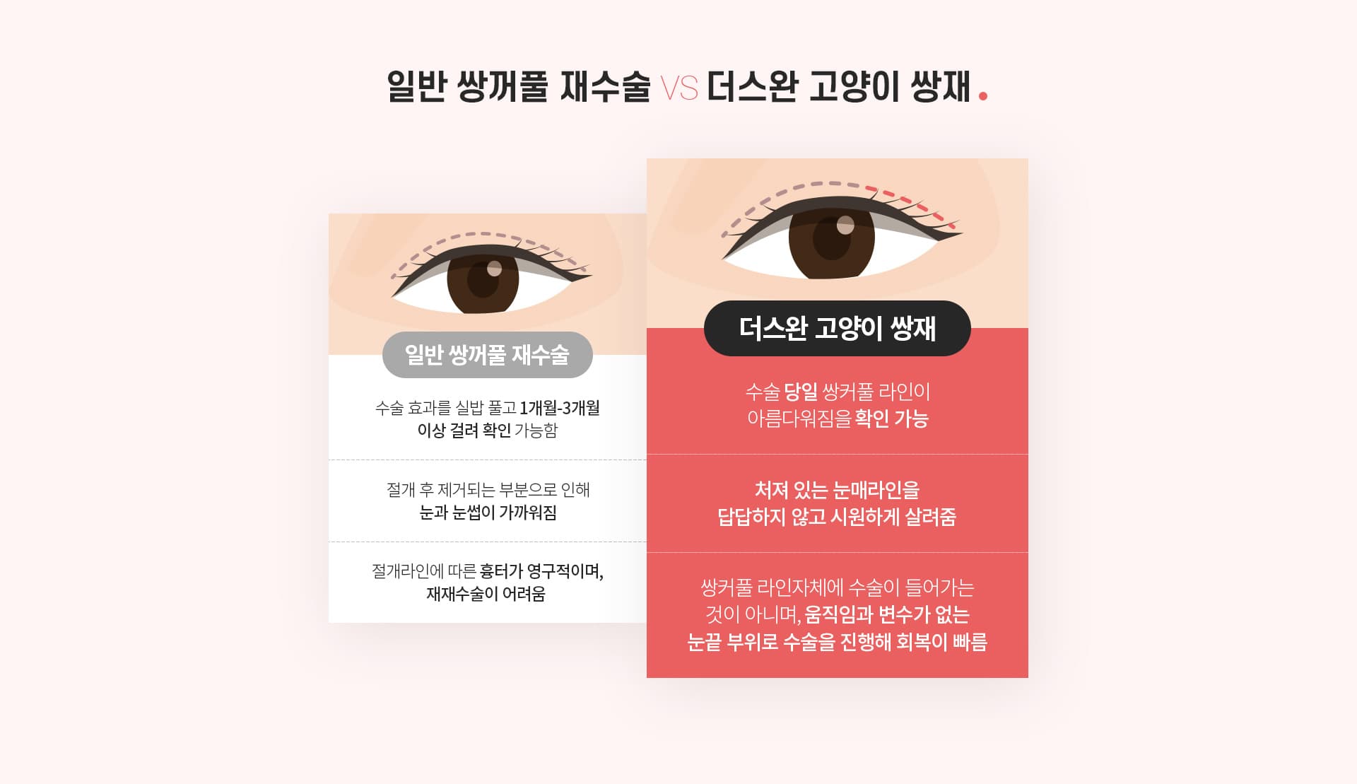 스완 고양이 눈성형 비교