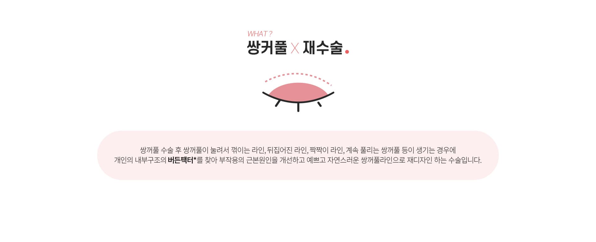 쌍커풀 재수술이란?