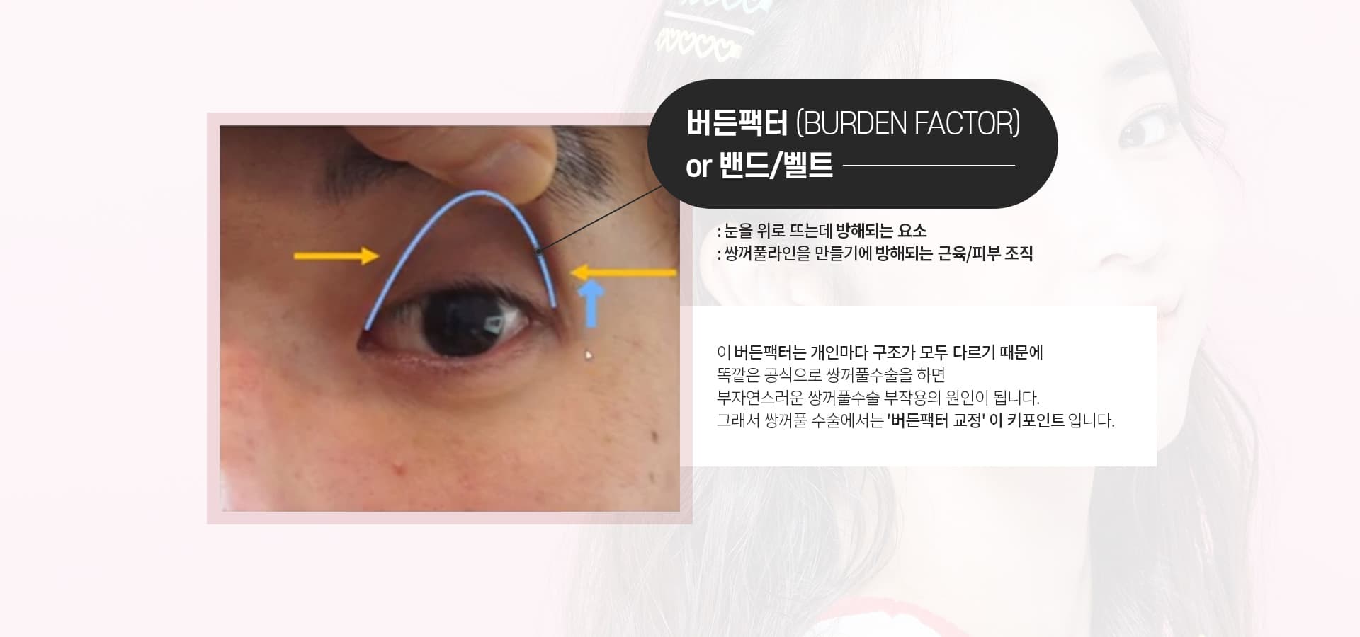 버든팩터