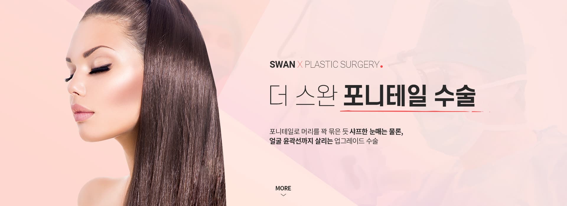 포니테일 수술 키비주얼