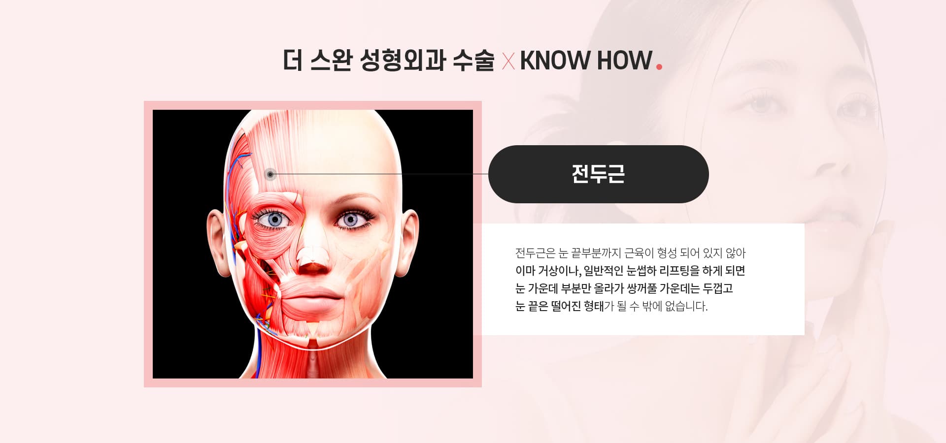 포니테일 수술 노하우