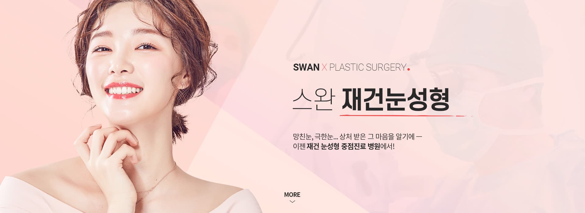 안검하수재수술 키비주얼