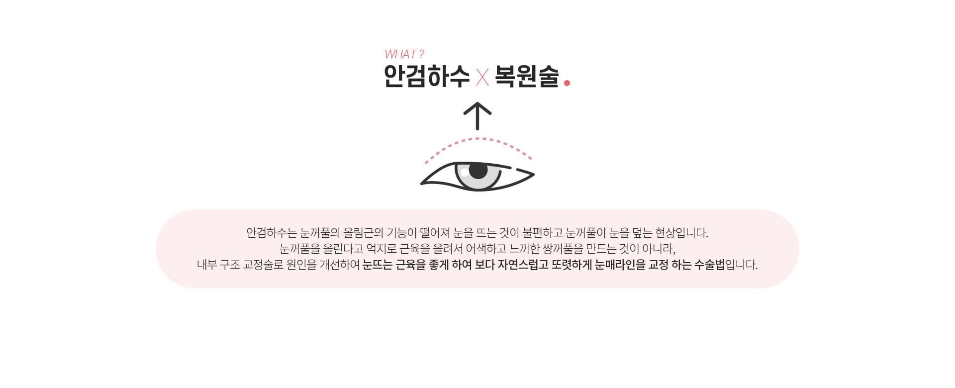 안검하수 복원술이란?