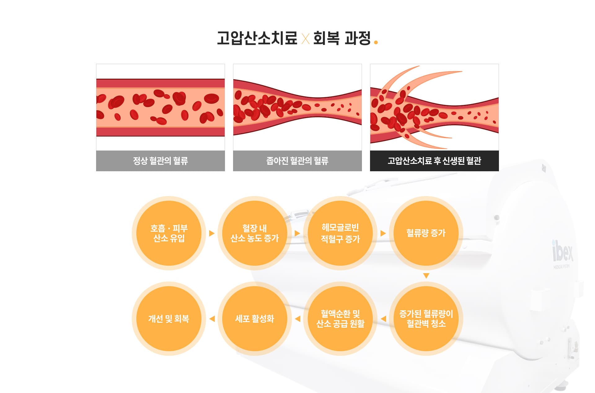 고압산소치료의 효과