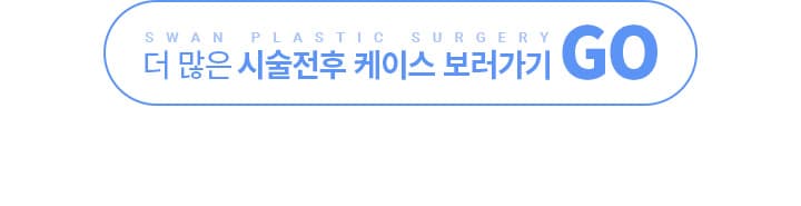 더 많은 시술전후 케이스 보러가기
