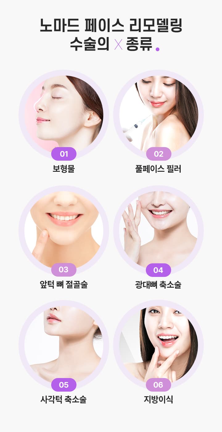 노마드 페이스 리모델링 수술의 종류