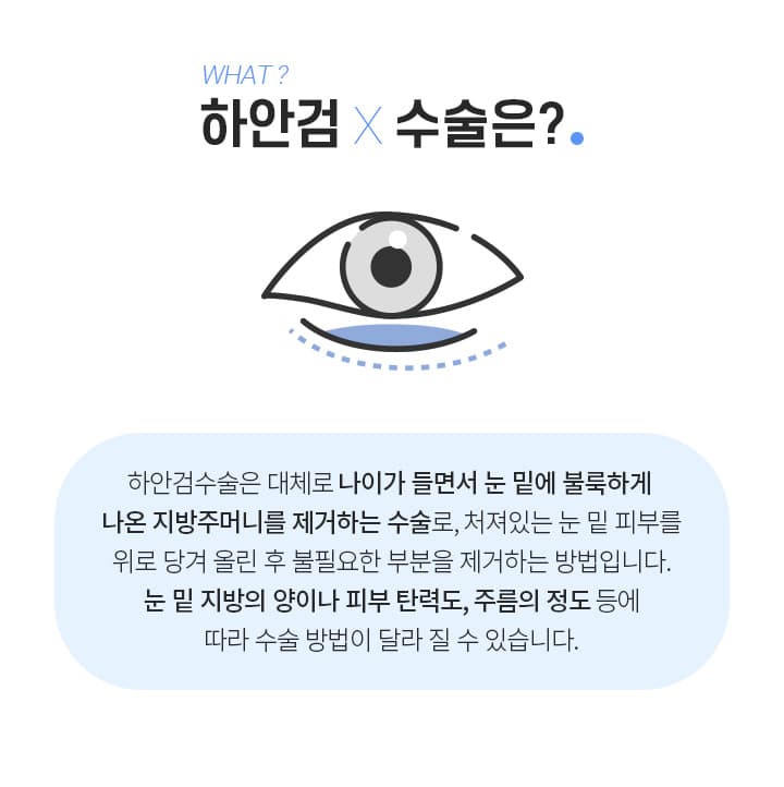 하안검수술은?