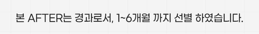 스완 매몰안검하수 하단문구