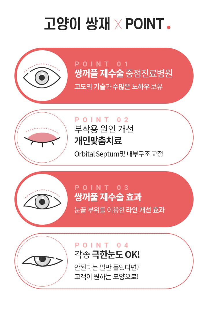 스완 고양이 눈성형 포인트