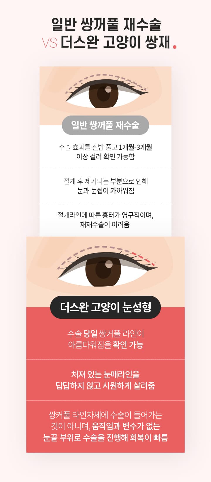 스완 고양이 눈성형 비교