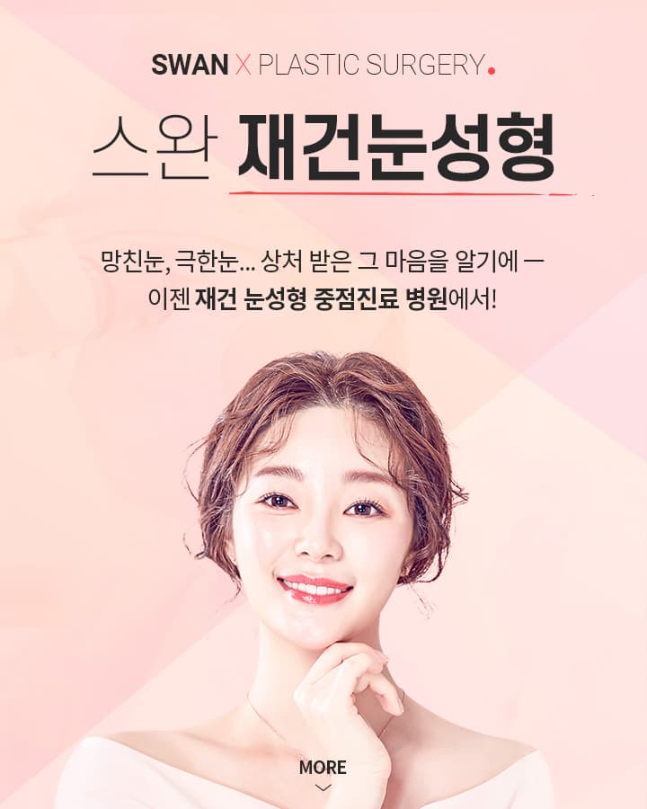쌍커풀 재수술 키비주얼