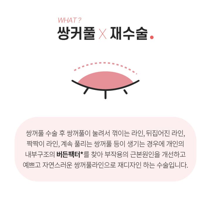 쌍커풀 재수술이란?