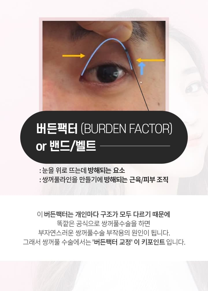 버든팩터
