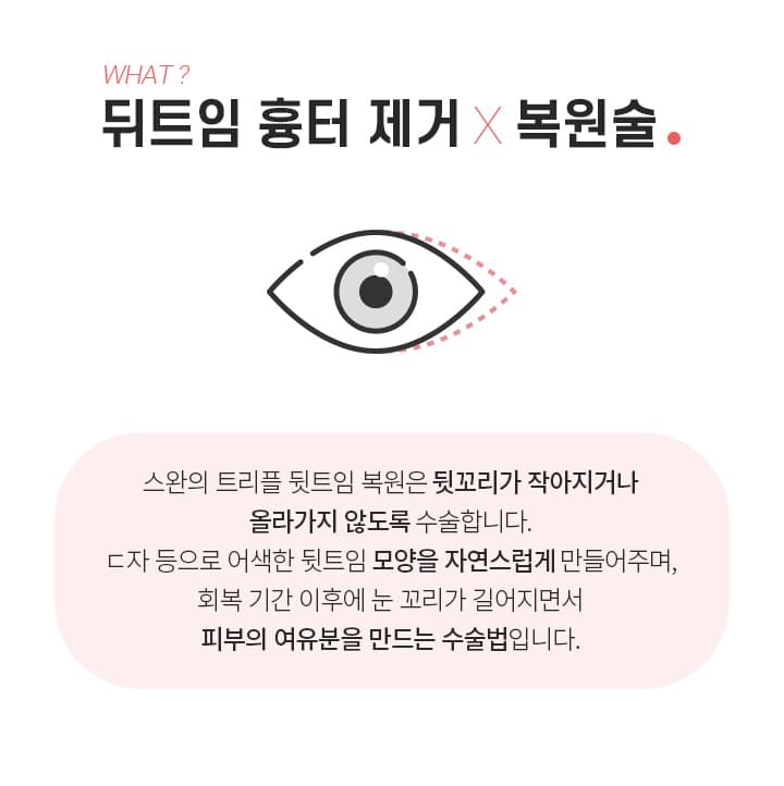 뒤트임 흉터 제거 복원술이란?