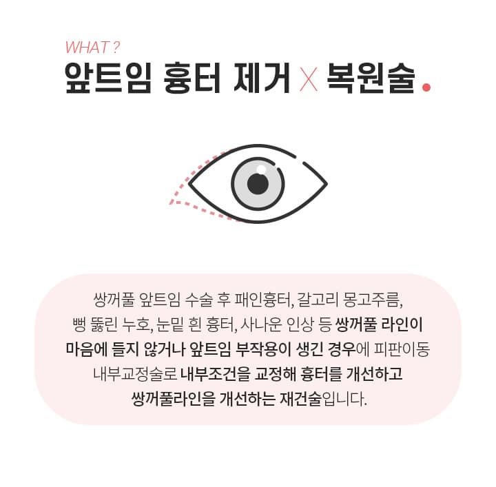 앞트임 흉터제거 복원술이란?