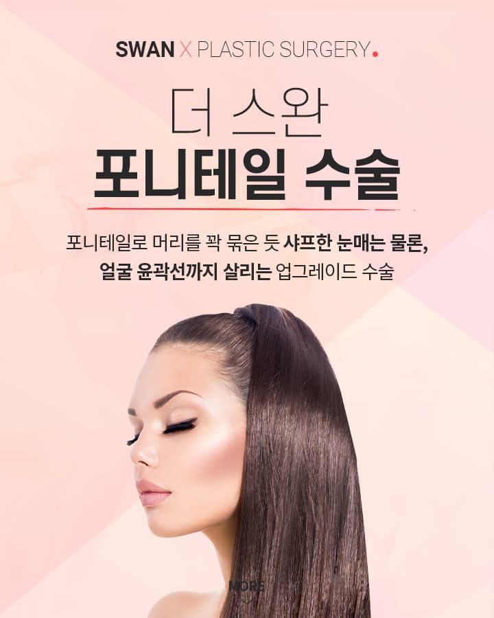 포니테일 수술 키비주얼