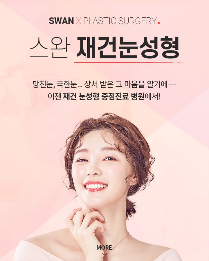 안검하수재수술 키비주얼