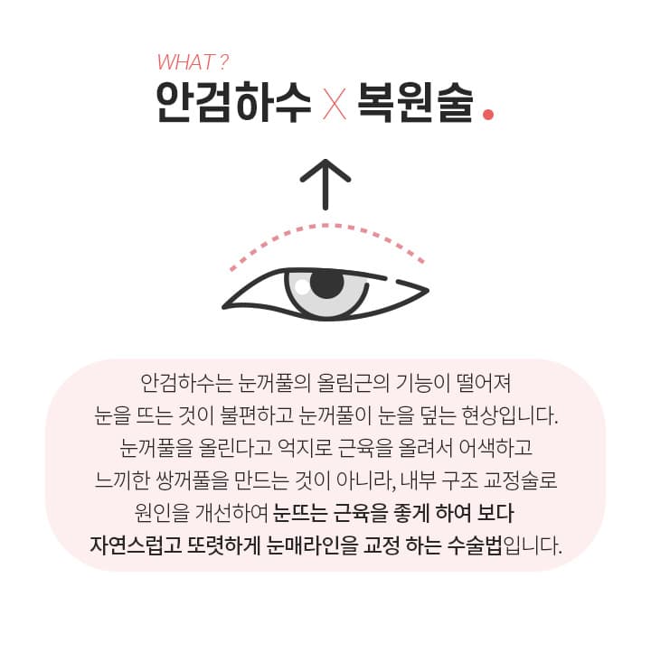 안검하수 복원술이란?