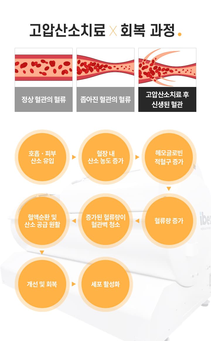 고압산소치료의 효과