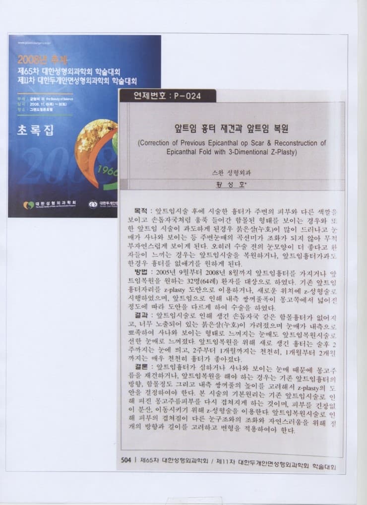 강남성형외과 강남 더스완성형외과 황성호 원장 — 2008 추계 제65차 대한성형외과학회 학술대회 앞트임 흉터 재건·복원 채택