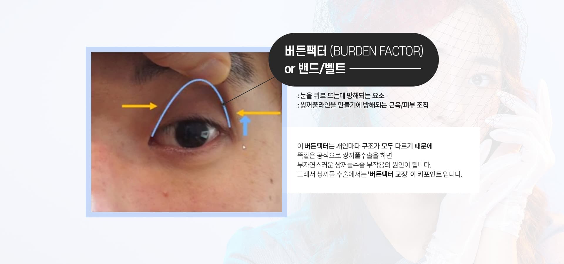 버든팩터