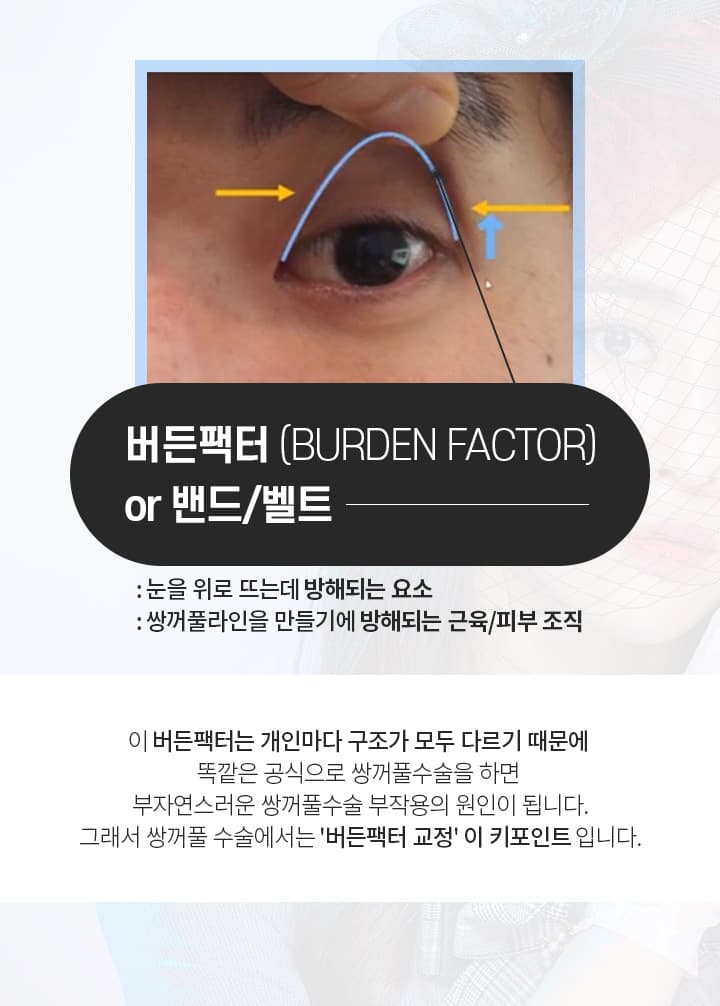 버든팩터