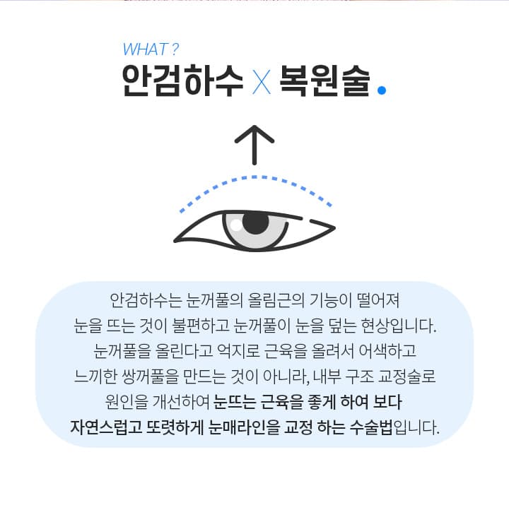 안검하수 복원술이란?