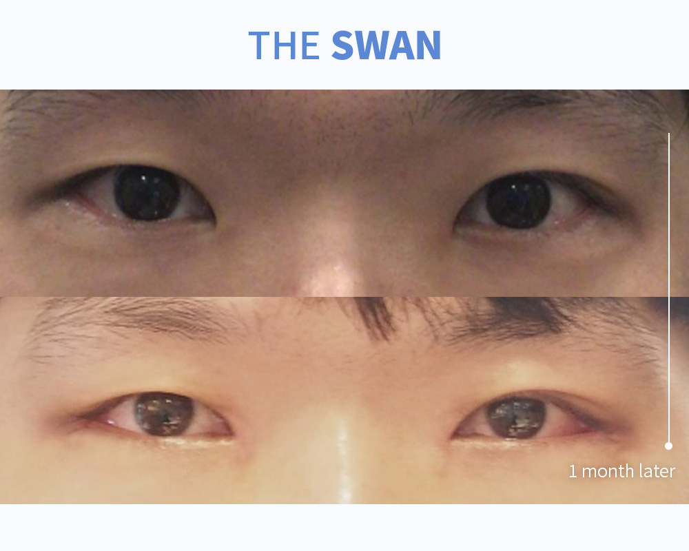 앞뒤각도전환